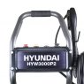 Hyundai Hyundai 210cc 2800psi Petrol Pressure Washer | HYW3000P2